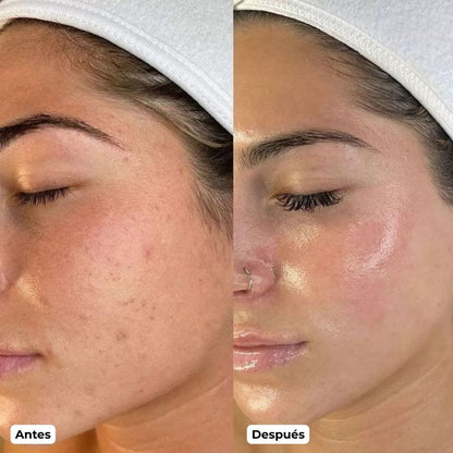 Mascarilla Coreana Nocturna de Colágeno Profundo PuraDerma™