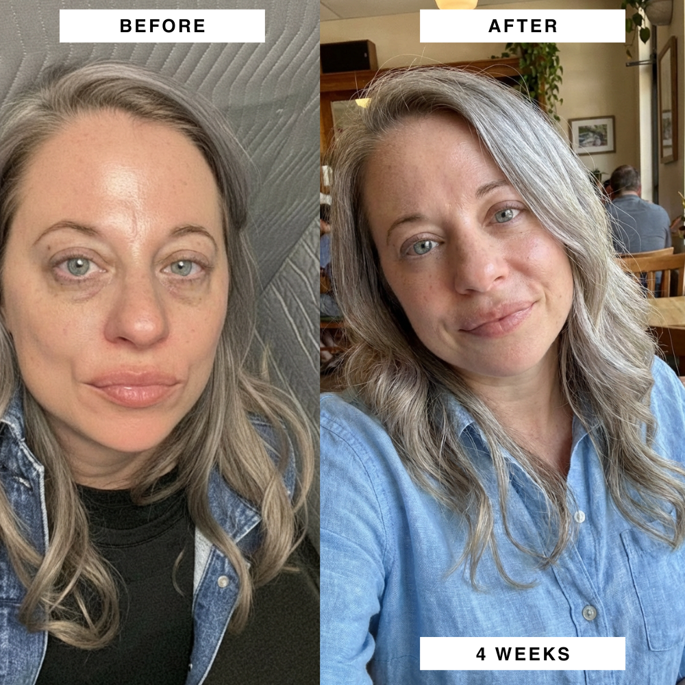 PuraDerma™ Patches - Reduces dark circles