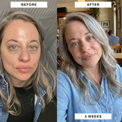 PuraDerma™ Patches - Reduces dark circles