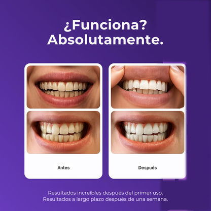 Puraderma Tiras Blanqueadoras Moradas