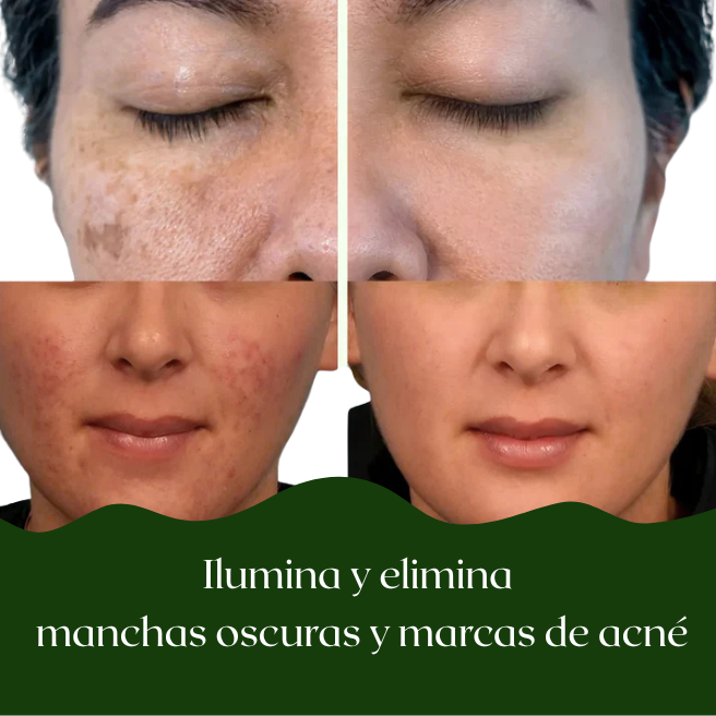 Pads Tonificantes Coreanos K8-Rejuvenate - Puraderma