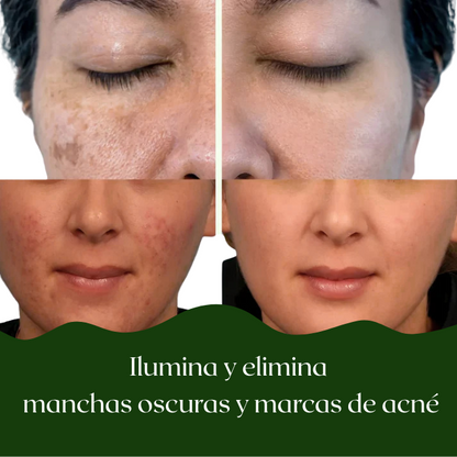 Pads Tonificantes Coreanos K8-Rejuvenate - Puraderma