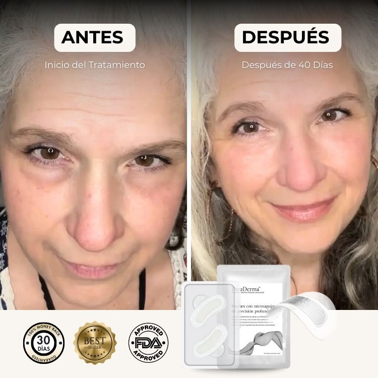 Parches PuraDerma™  - Reduce las ojeras