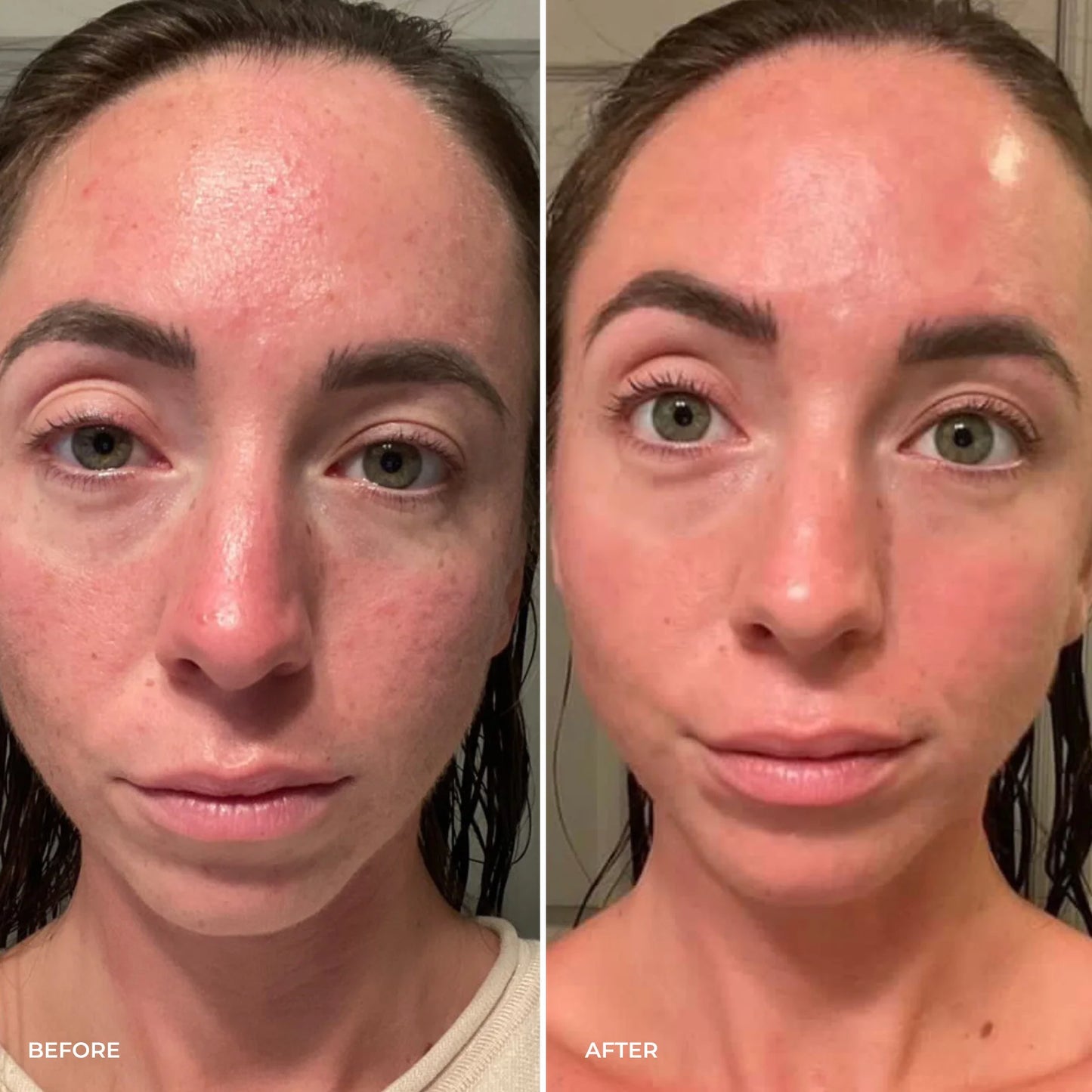 Parches PuraDerma™  - Reduce las ojeras