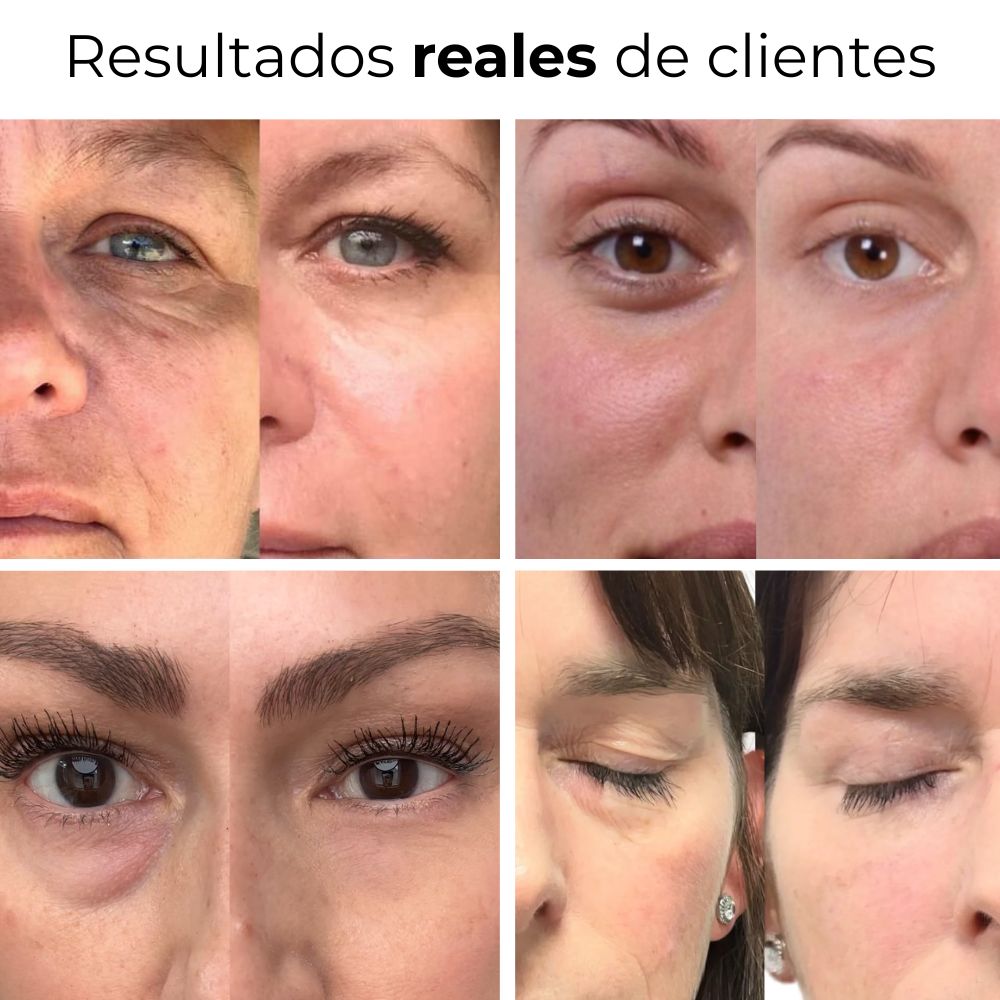 Parches PuraDerma™