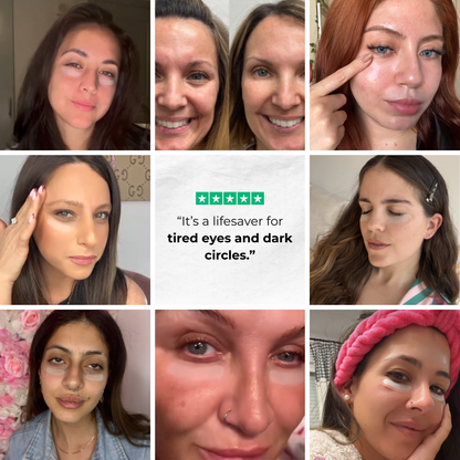 PuraDerma™ Patches - Reduces dark circles