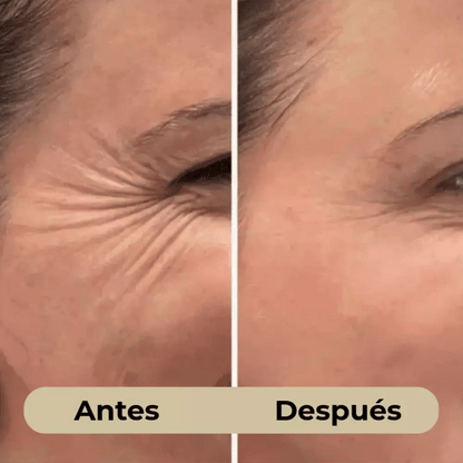 El Bundle de Transformación