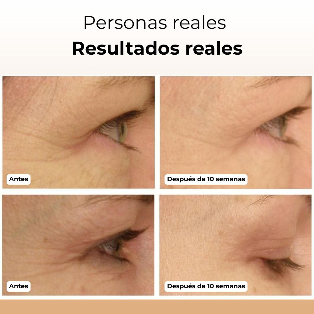 PuraDerma™ Cuidado de Ojos Pro