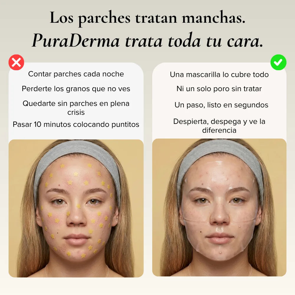 PuraDerma™ Mascarilla Hidrocoloide Anti-Imperfecciones Cobertura Total