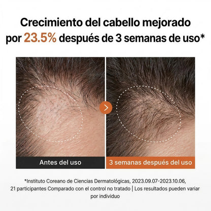 Suero para el Crecimiento del Cabello con Cepillo Incorporado